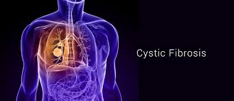 Cystic Fibrosis